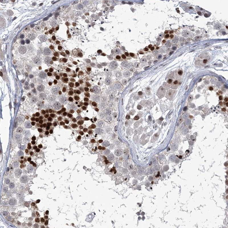 Homez Antibody - BSA Free Immunohistochemistry-Paraffin: Homez Antibody [NBP2-32661]