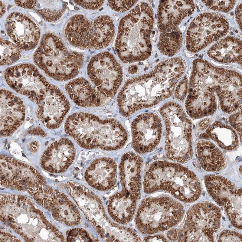 AASDH Antibody - BSA Free Immunohistochemistry: AASDH Antibody - BSA Free [NBP2-32667]