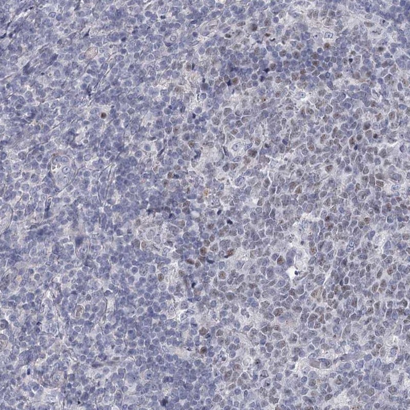 FAM76B Antibody - BSA Free Immunohistochemistry-Paraffin: FAM76B Antibody [NBP2-32670]