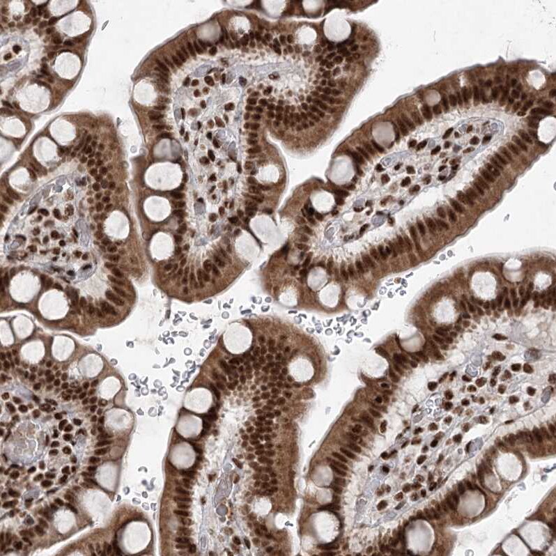 CGGBP1 Antibody - BSA Free Immunohistochemistry-Paraffin: CGGBP1 Antibody [NBP2-32680]