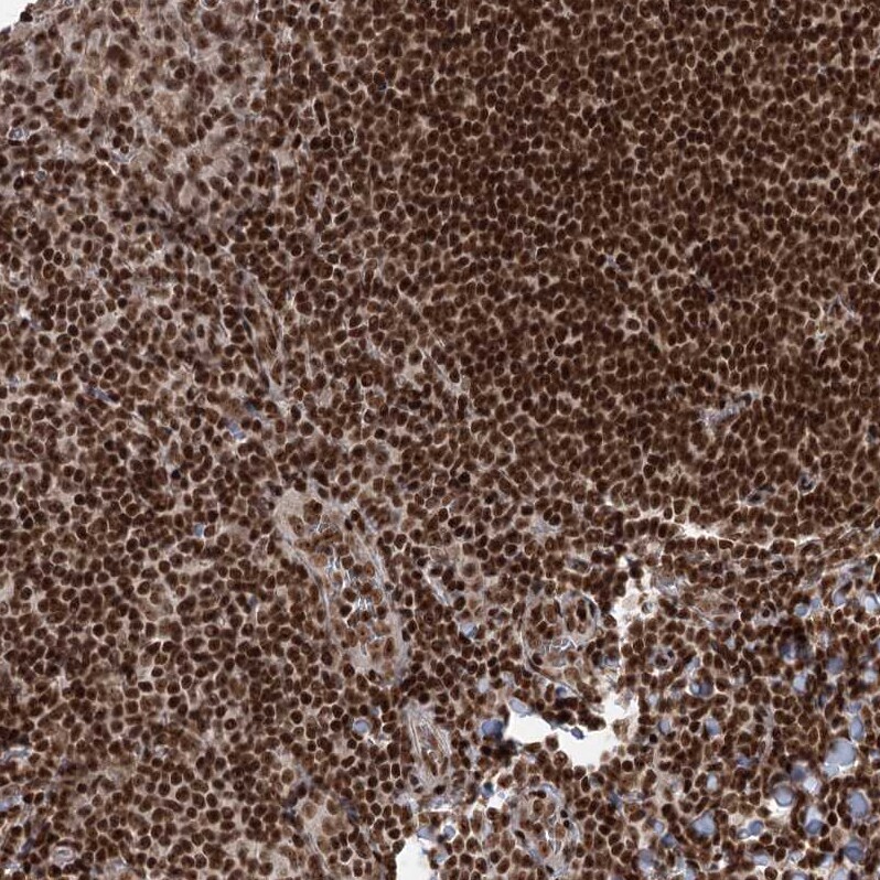 CGGBP1 Antibody - BSA Free Immunohistochemistry-Paraffin: CGGBP1 Antibody [NBP2-32680]