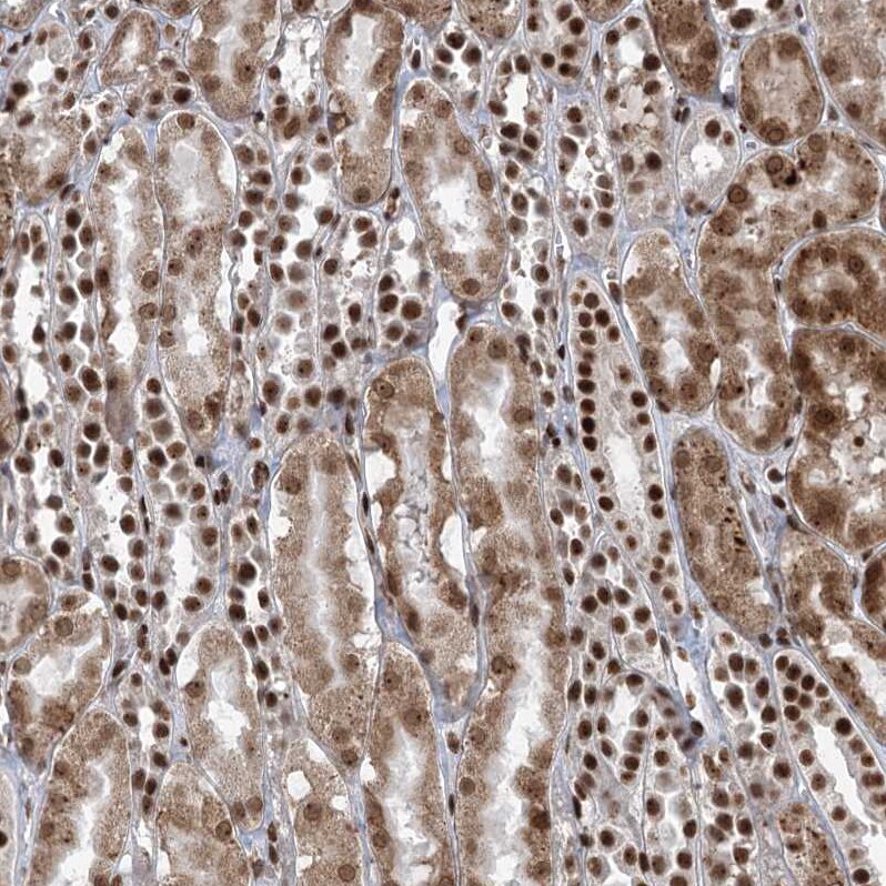 CGGBP1 Antibody - BSA Free Immunohistochemistry-Paraffin: CGGBP1 Antibody [NBP2-32680]