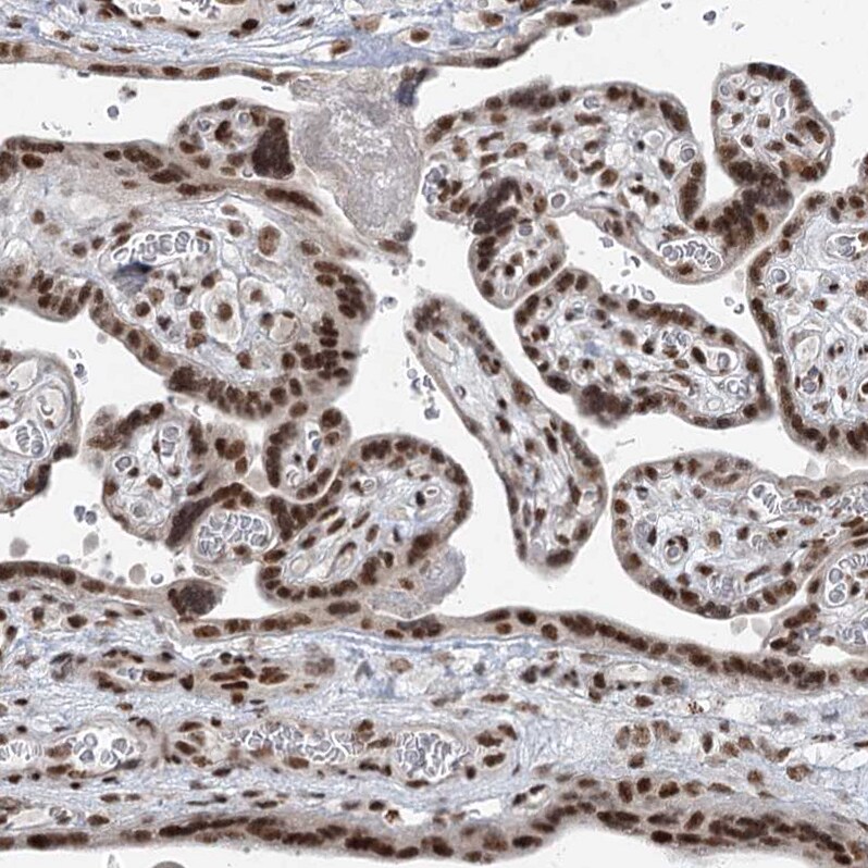 CGGBP1 Antibody - BSA Free Immunohistochemistry-Paraffin: CGGBP1 Antibody [NBP2-32680]