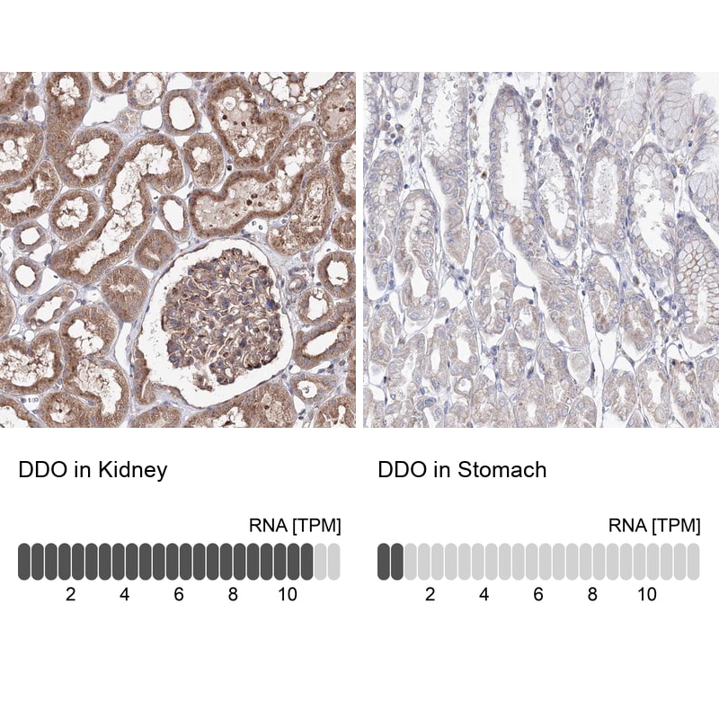 DDO Antibody - BSA Free Immunohistochemistry-Paraffin: DDO Antibody [NBP2-32684]