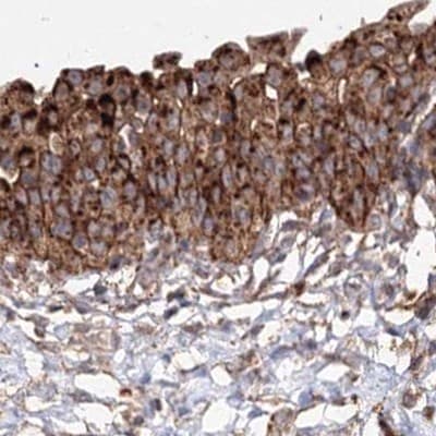 DDO Antibody - BSA Free Immunohistochemistry-Paraffin: DDO Antibody [NBP2-32684]