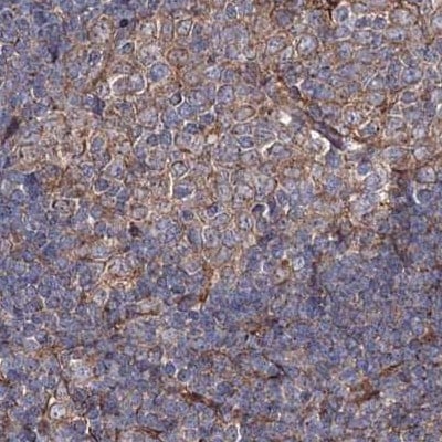 DDO Antibody - BSA Free Immunohistochemistry-Paraffin: DDO Antibody [NBP2-32684]