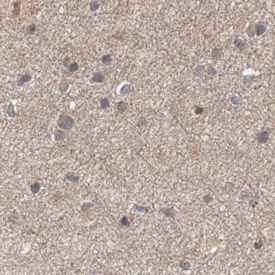 DDO Antibody - BSA Free Immunohistochemistry-Paraffin: DDO Antibody [NBP2-32684]