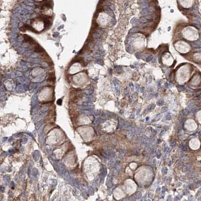DDO Antibody - BSA Free Immunohistochemistry-Paraffin: DDO Antibody [NBP2-32684]