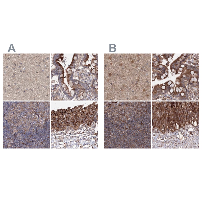DDO Antibody - BSA Free Immunohistochemistry-Paraffin: DDO Antibody [NBP2-32684]