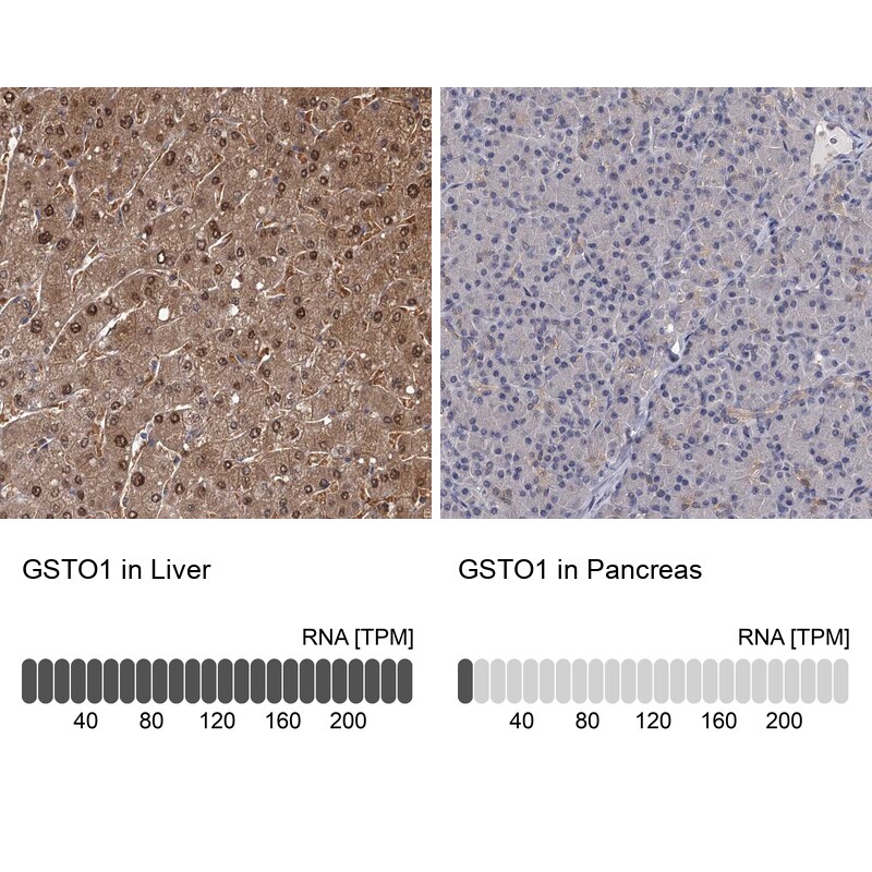 GSTO1 Antibody - BSA Free Immunohistochemistry-Paraffin: GSTO1 Antibody [NBP2-32691]