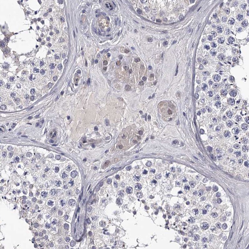 GSTO1 Antibody - BSA Free Immunohistochemistry-Paraffin: GSTO1 Antibody [NBP2-32691]