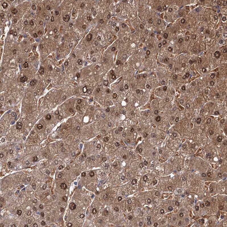 GSTO1 Antibody - BSA Free Immunohistochemistry-Paraffin: GSTO1 Antibody [NBP2-32691]