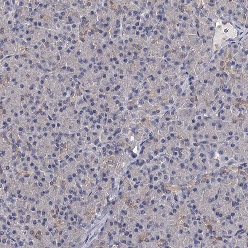 GSTO1 Antibody - BSA Free Immunohistochemistry-Paraffin: GSTO1 Antibody [NBP2-32691]
