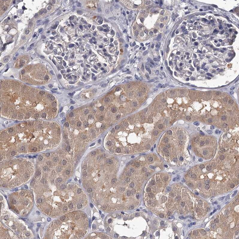 GSTO1 Antibody - BSA Free Immunohistochemistry-Paraffin: GSTO1 Antibody [NBP2-32691]