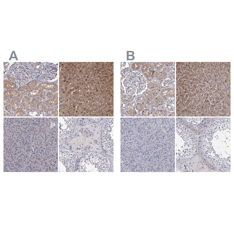 GSTO1 Antibody - BSA Free Immunohistochemistry-Paraffin: GSTO1 Antibody [NBP2-32691]