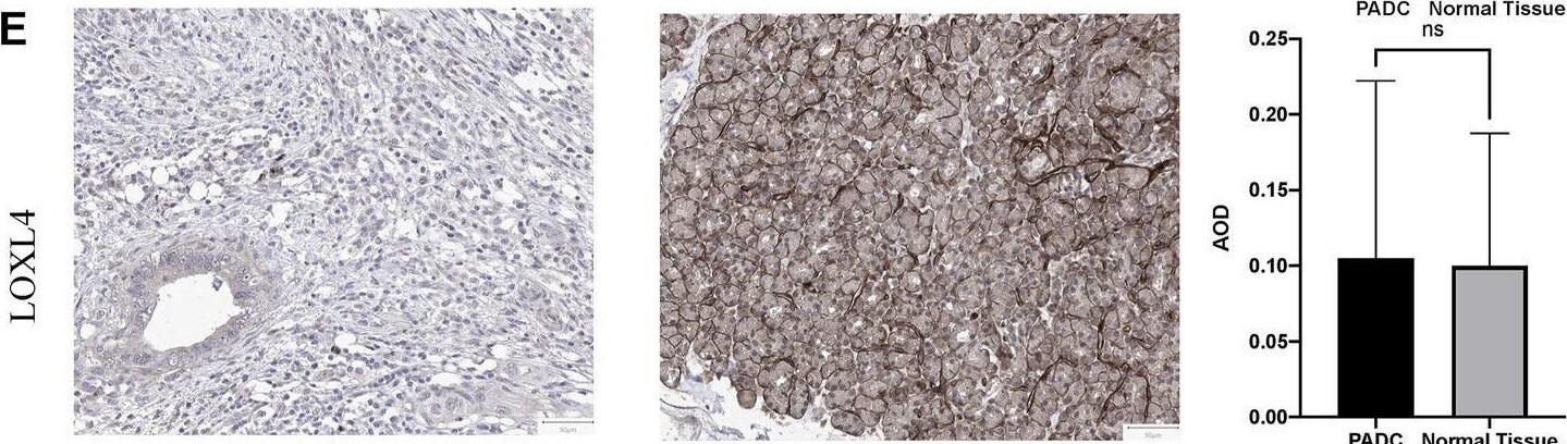 LOXL4 Antibody - BSA Free
