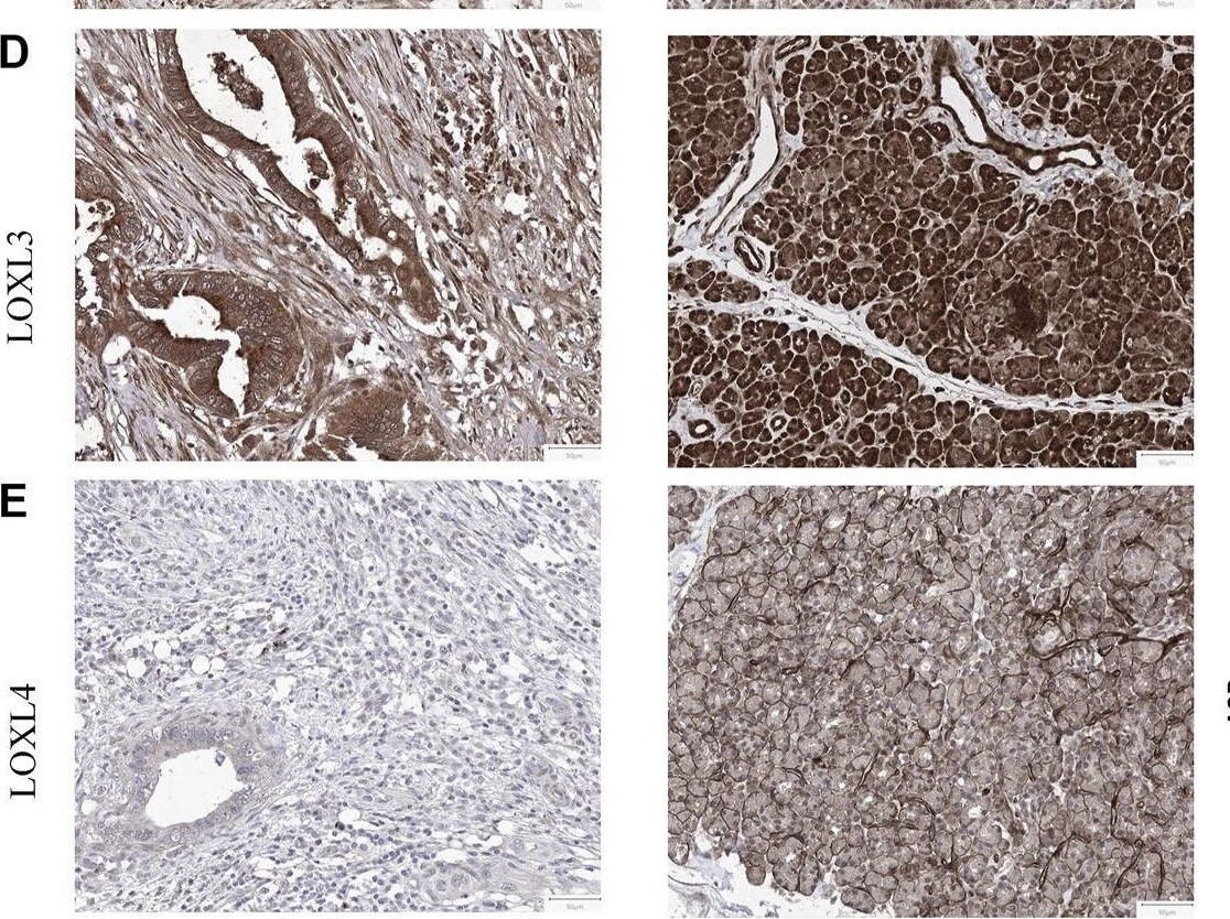 LOXL4 Antibody - BSA Free