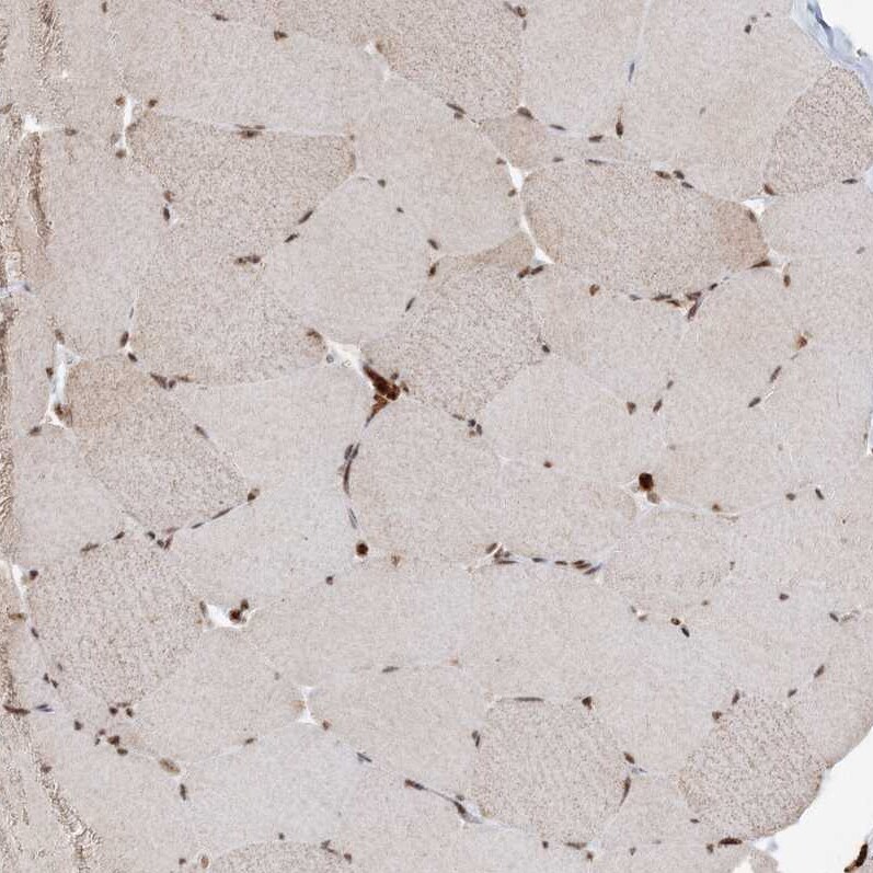 QRICH1 Antibody - BSA Free Immunohistochemistry-Paraffin: QRICH1 Antibody [NBP2-32693]