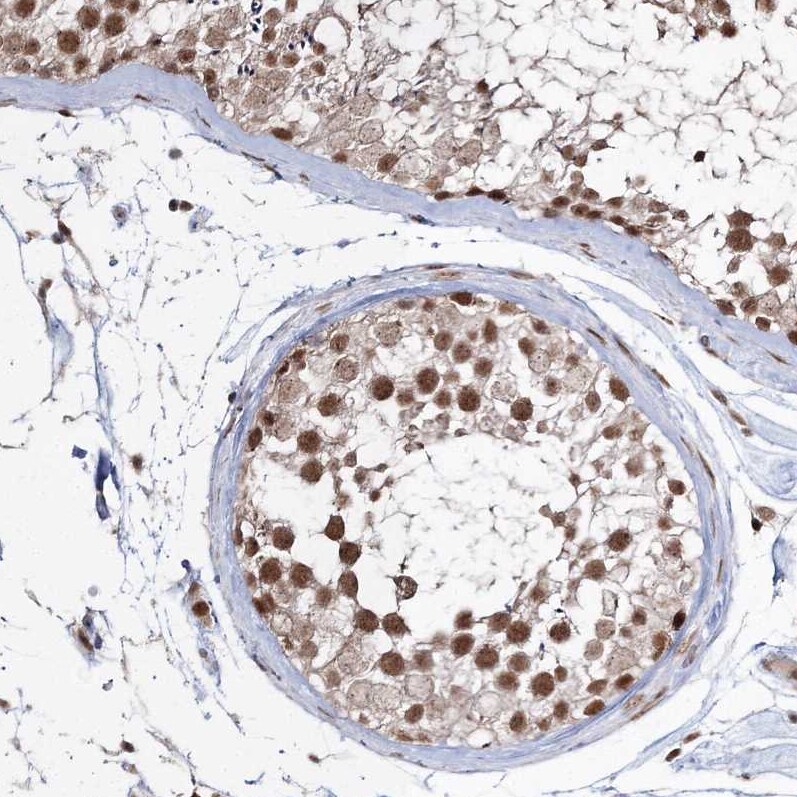 QRICH1 Antibody - BSA Free Immunohistochemistry-Paraffin: QRICH1 Antibody [NBP2-32693]