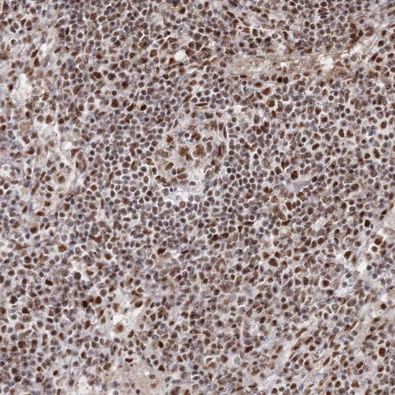 QRICH1 Antibody - BSA Free Immunohistochemistry-Paraffin: QRICH1 Antibody [NBP2-32693]