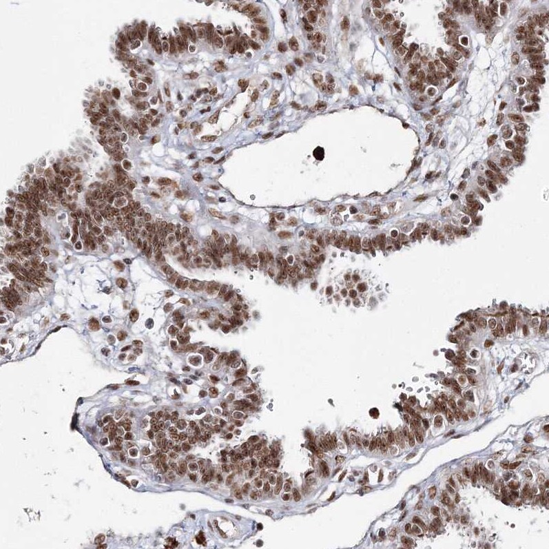 QRICH1 Antibody - BSA Free Immunohistochemistry-Paraffin: QRICH1 Antibody [NBP2-32693]