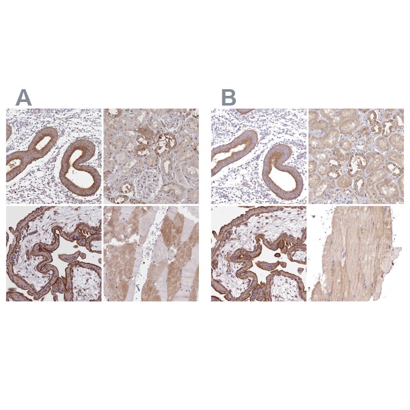 FCHO2 Antibody Immunohistochemistry-Paraffin: FCHO2 Antibody Antibody [NBP2-32694]