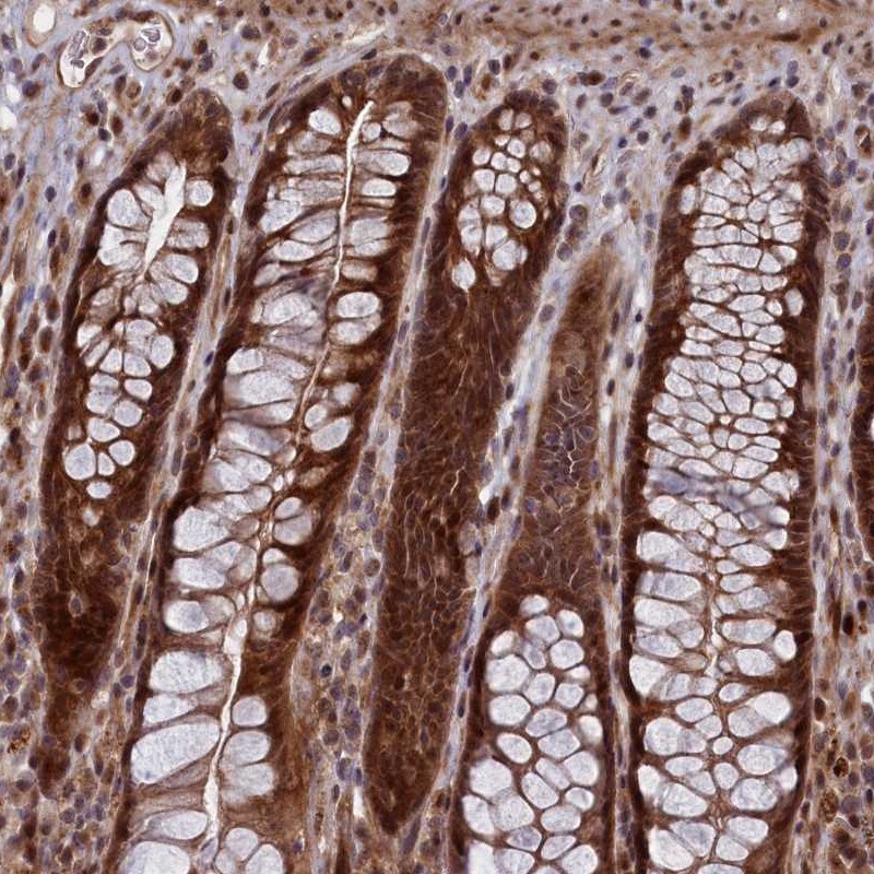 LSG1 Antibody - BSA Free Immunohistochemistry-Paraffin: LSG1 Antibody [NBP2-32698]
