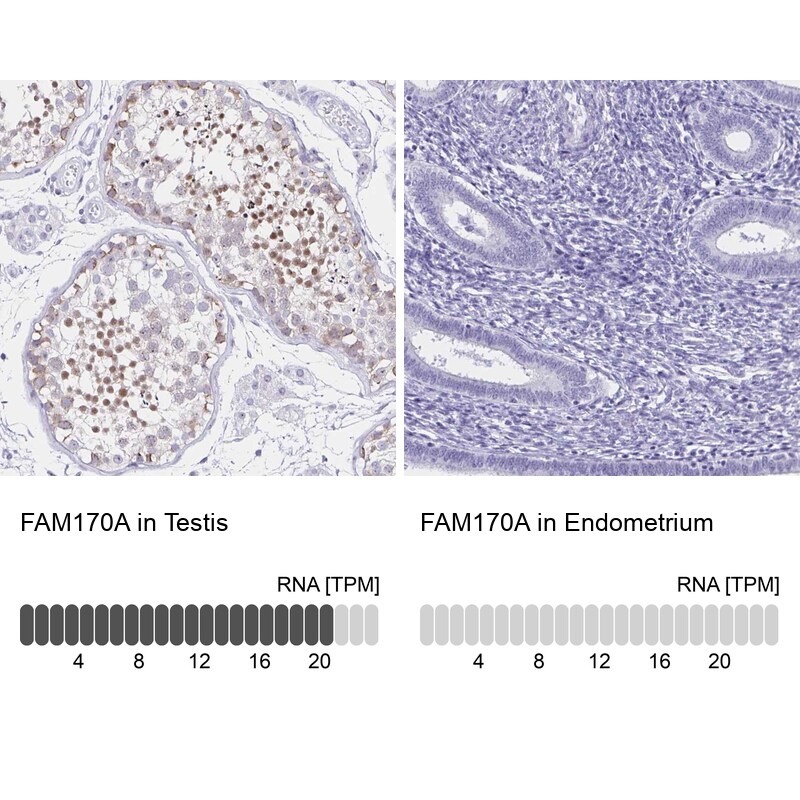 FAM170A Antibody - BSA Free Immunohistochemistry-Paraffin: FAM170A Antibody [NBP2-32707]
