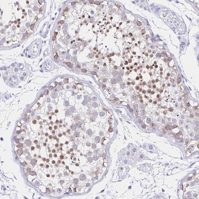 FAM170A Antibody - BSA Free Immunohistochemistry-Paraffin: FAM170A Antibody [NBP2-32707]