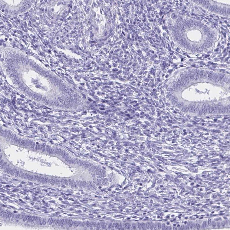 FAM170A Antibody - BSA Free Immunohistochemistry-Paraffin: FAM170A Antibody [NBP2-32707]