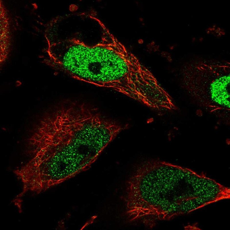 CDC7 Antibody - BSA Free Immunocytochemistry/ Immunofluorescence: CDC7 Antibody [NBP2-32708]