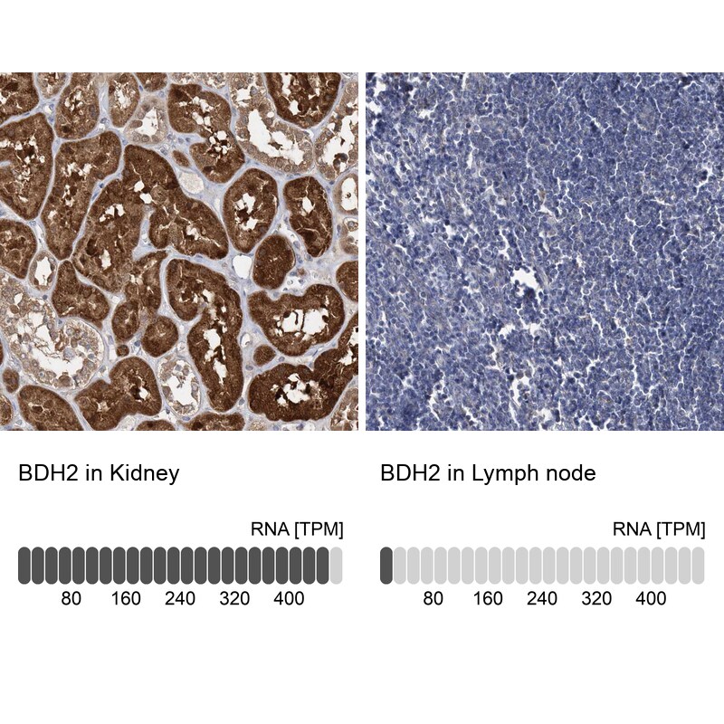 BDH2 Antibody - BSA Free Immunohistochemistry-Paraffin: BDH2 Antibody [NBP2-32713]