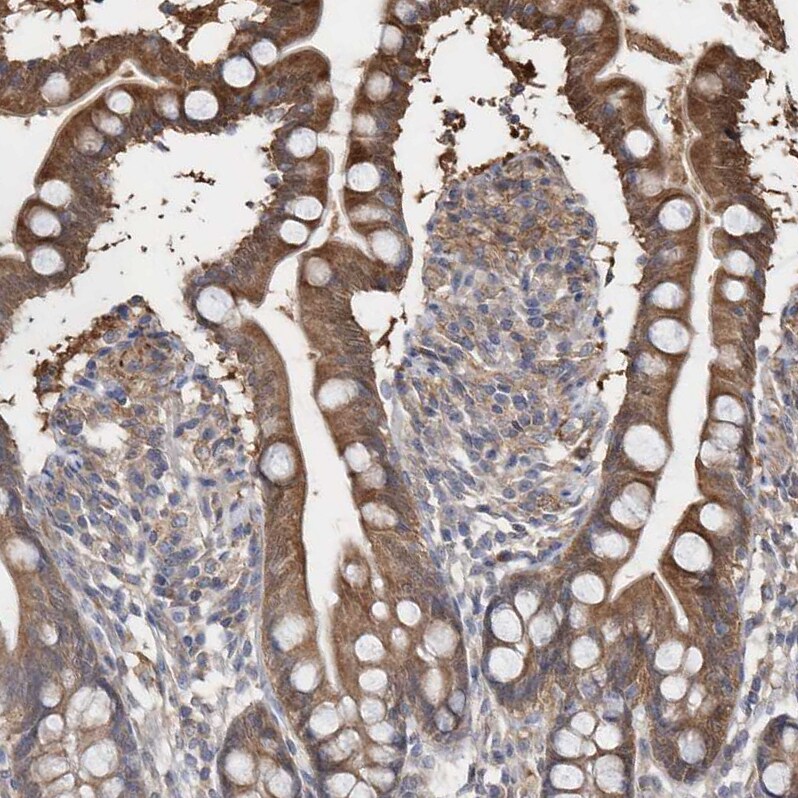 BDH2 Antibody - BSA Free Immunohistochemistry-Paraffin: BDH2 Antibody [NBP2-32713]