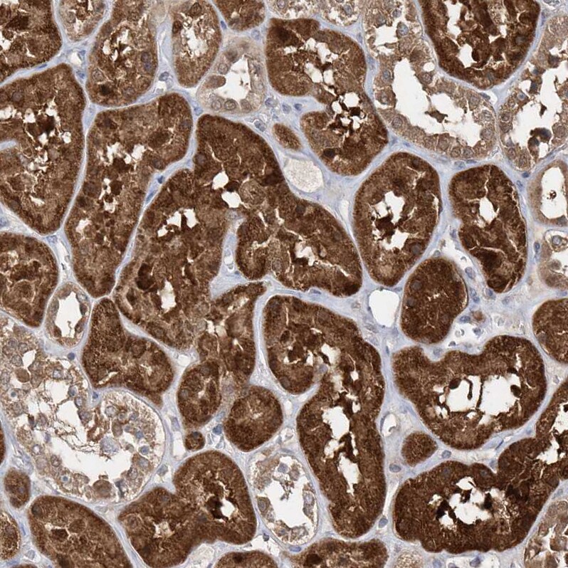 BDH2 Antibody - BSA Free Immunohistochemistry-Paraffin: BDH2 Antibody [NBP2-32713]
