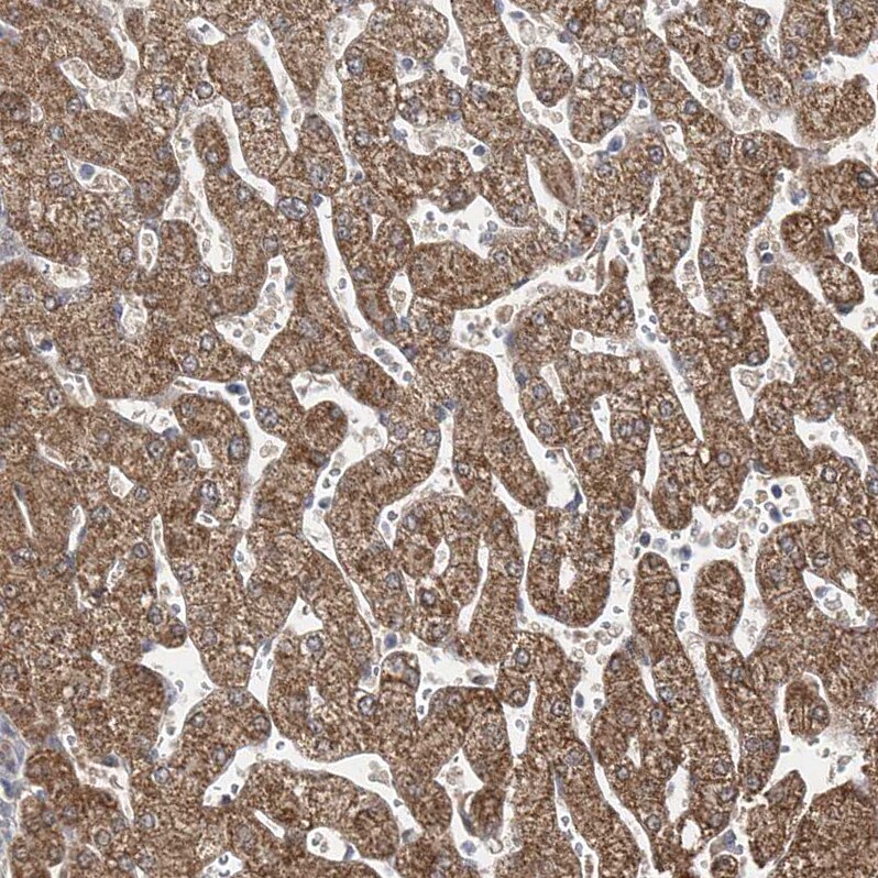 BDH2 Antibody - BSA Free Immunohistochemistry-Paraffin: BDH2 Antibody [NBP2-32713]