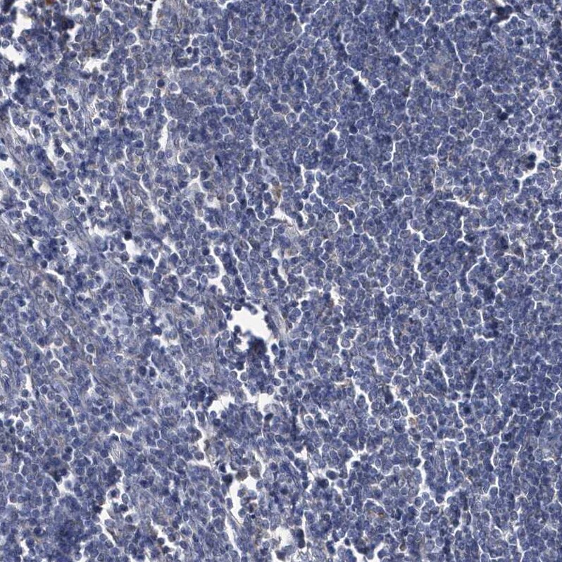 BDH2 Antibody - BSA Free Immunohistochemistry-Paraffin: BDH2 Antibody [NBP2-32713]
