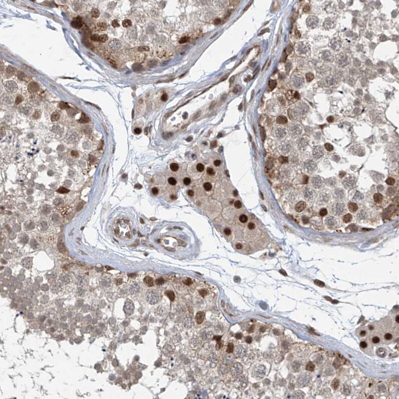 LAGE3 Antibody - BSA Free Immunohistochemistry-Paraffin: LAGE3 Antibody [NBP2-32715]