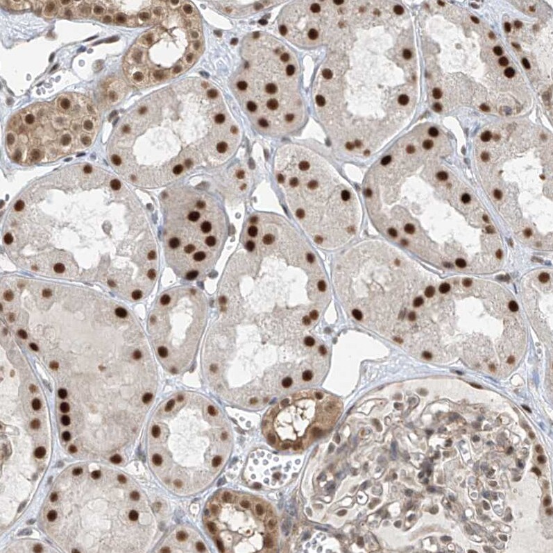 LAGE3 Antibody - BSA Free Immunohistochemistry-Paraffin: LAGE3 Antibody [NBP2-32715]