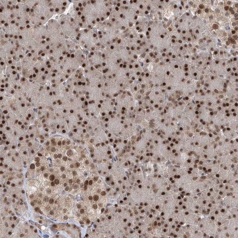 LAGE3 Antibody - BSA Free Immunohistochemistry-Paraffin: LAGE3 Antibody [NBP2-32715]