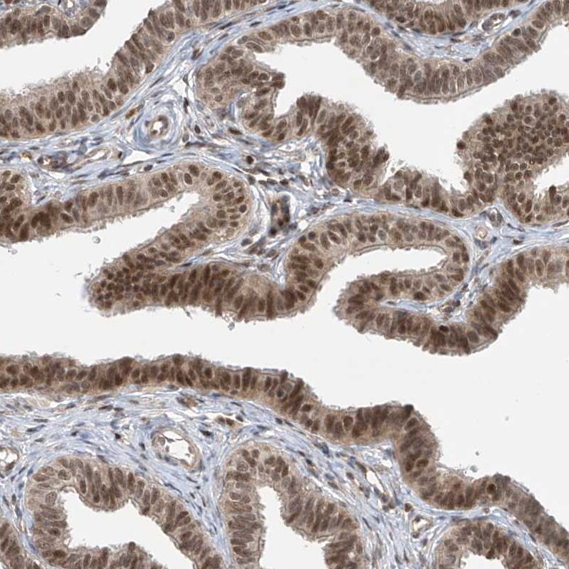 LAGE3 Antibody - BSA Free Immunohistochemistry-Paraffin: LAGE3 Antibody [NBP2-32715]