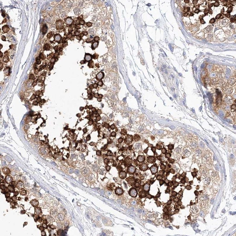 SHCBP1L Antibody - BSA Free Immunohistochemistry: SHCBP1L Antibody - BSA Free [NBP2-32716]