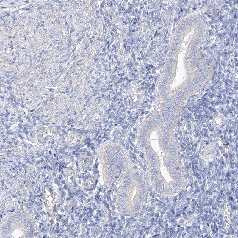SHCBP1L Antibody - BSA Free Immunohistochemistry: SHCBP1L Antibody - BSA Free [NBP2-32716]