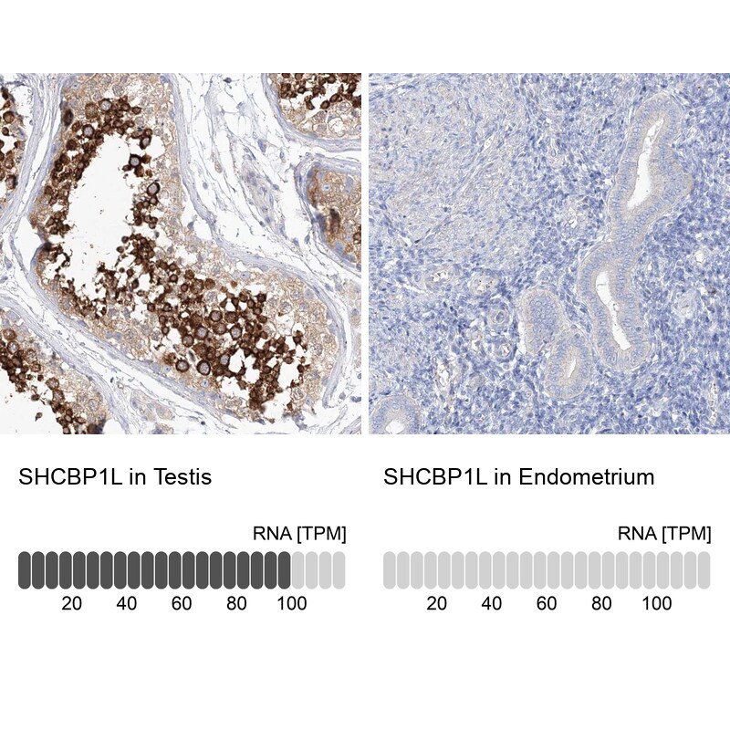 SHCBP1L Antibody - BSA Free Immunohistochemistry: SHCBP1L Antibody - BSA Free [NBP2-32716]
