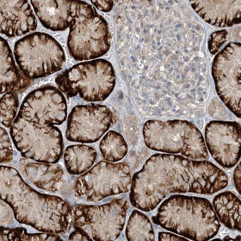 MITD1 Antibody - BSA Free Immunohistochemistry-Paraffin: MITD1 Antibody [NBP2-32721]