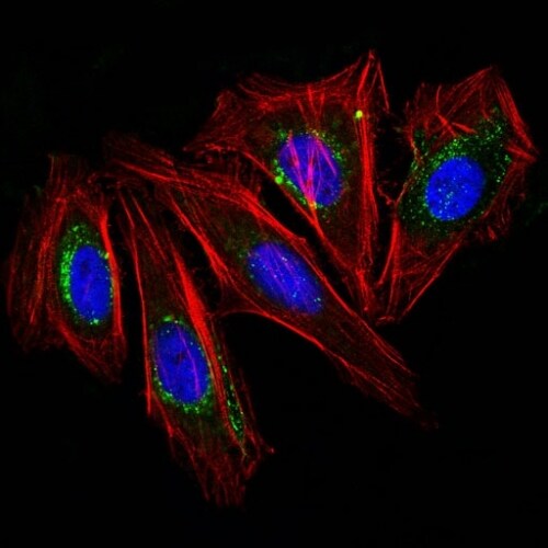 CD63 Antibody (NKI/C3) Immunocytochemistry/ Immunofluorescence: CD63 Antibody (NKI/C3) [NBP2-32829] -