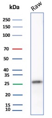 p27/Kip1 Antibody (SX53G8) Western Blot: p27/Kip1 Antibody (SX53G8) [NBP2-32889] -