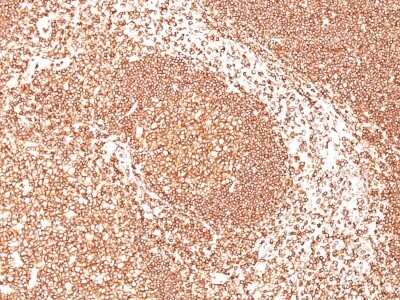 CD45 Antibody (SPM570)