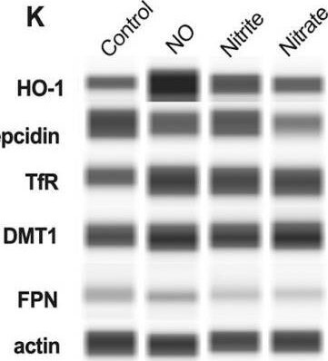 TfR (Transferrin R) Antibody (DF1513)