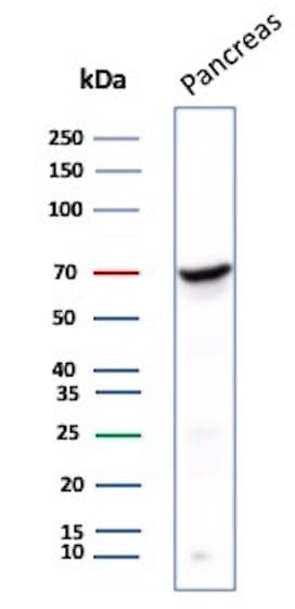Chromogranin A Antibody (LK2H10) Western Blot: Chromogranin A Antibody (LK2H10) [NBP2-32956] -