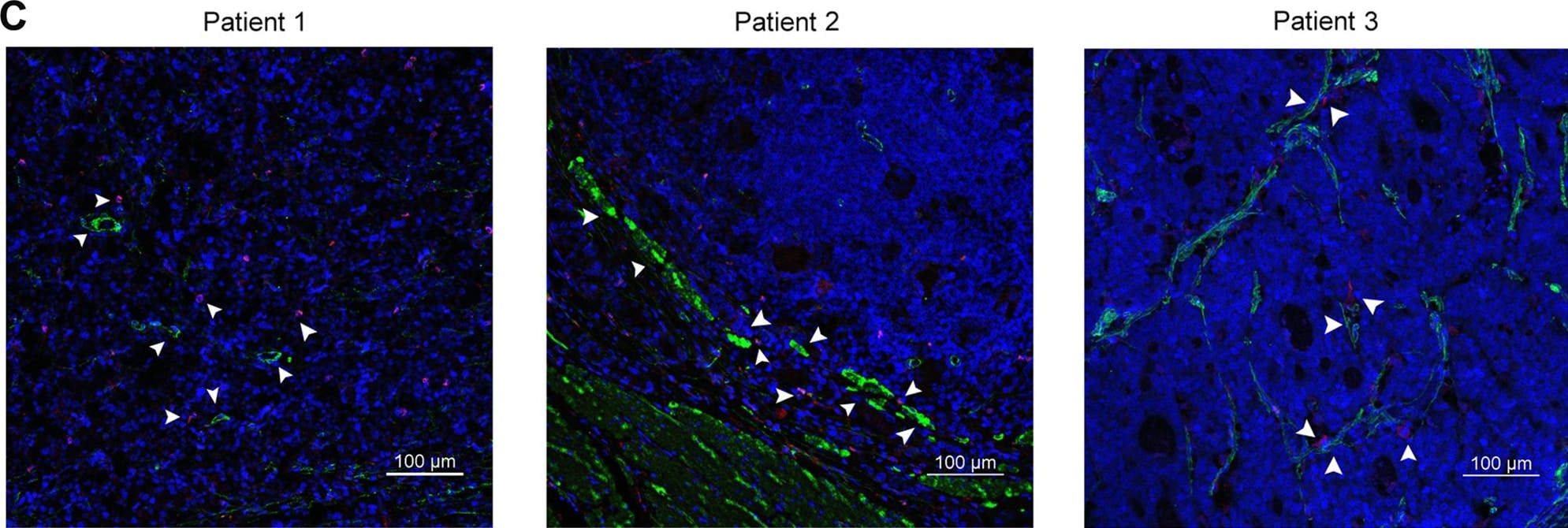 alpha-Smooth Muscle Actin Antibody (1A4/asm-1) - BSA Free